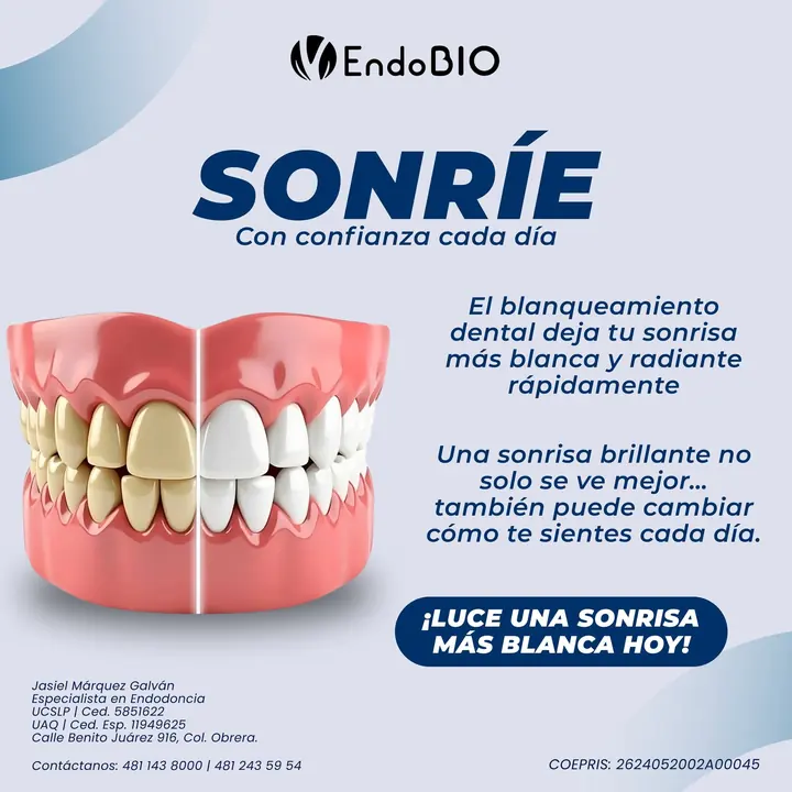 Publicación de EndoBio: Sonríe con confianza cada día, blanqueamiento dental
